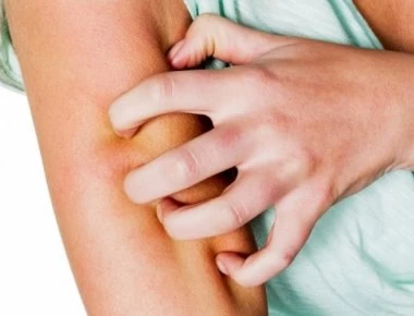 Ψώρα: Πώς θα καταλάβετε ότι έχετε πρόβλημα - Ποια θεραπεία υπάρχει